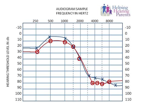 LM 212: Hearing Aids for Babies: Predicting Audiograms from.